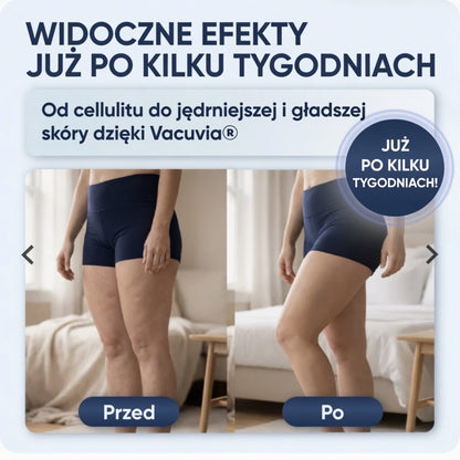 SkinVac® - jędrniejsza, bardziej napięta skóra